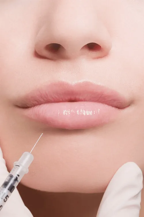 Lip fillers